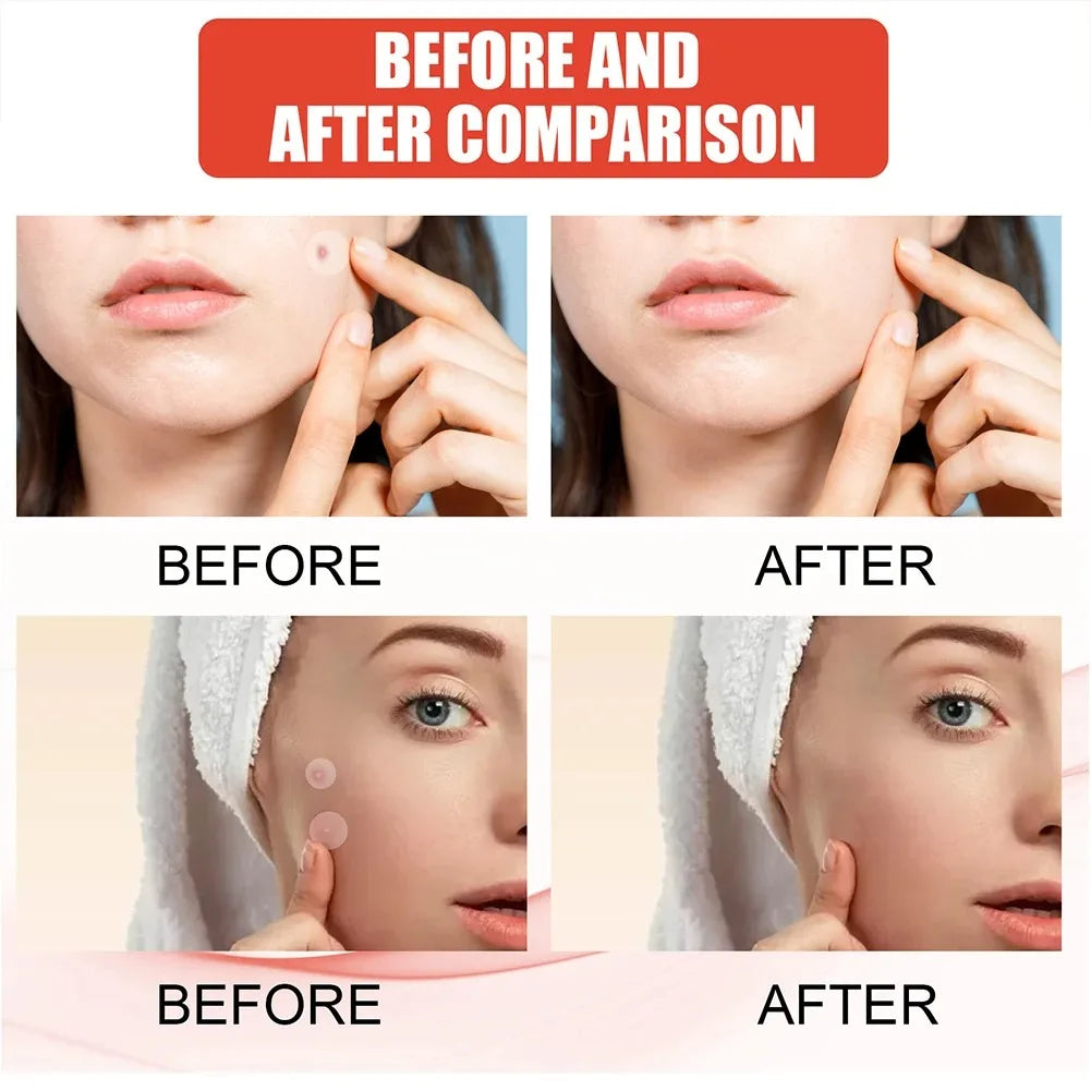 ClearSkin Patch™
