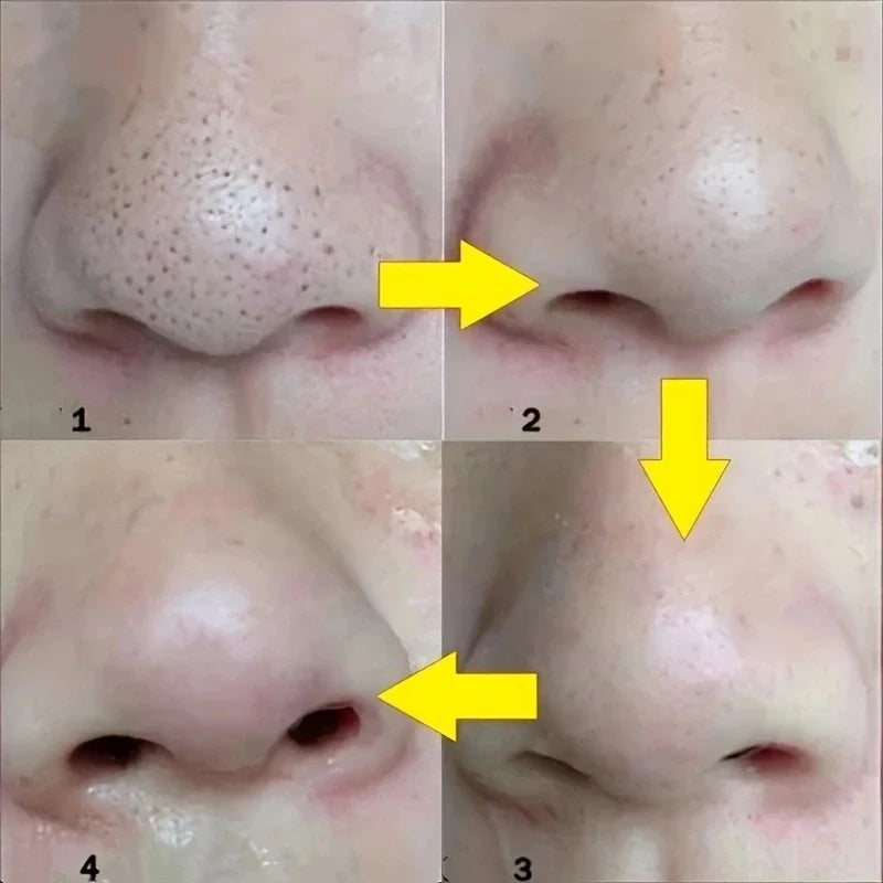 PureNose™ Strips