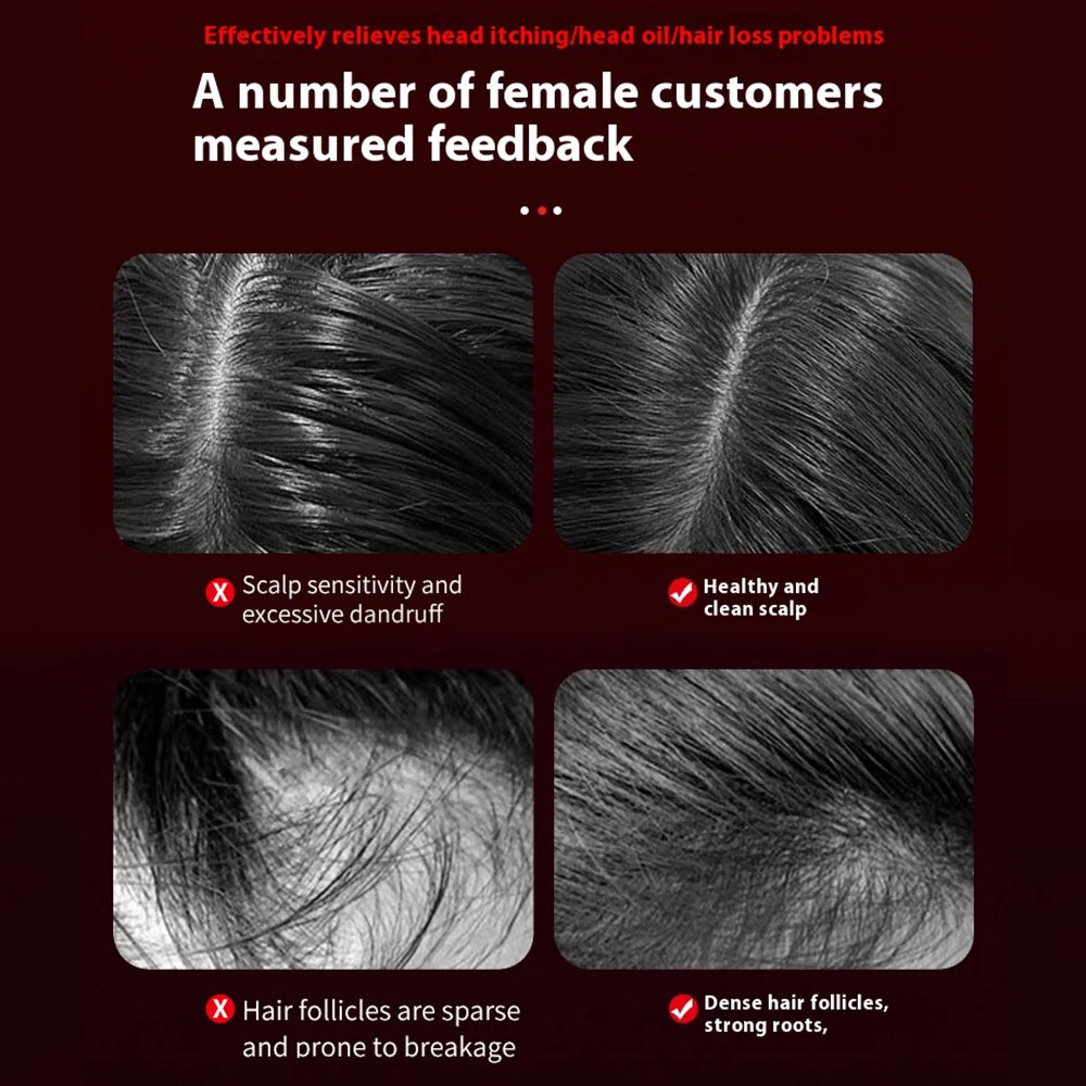 LumiScalp™ Pro – Red Light Scalp Massager for Hair Growth & Loss